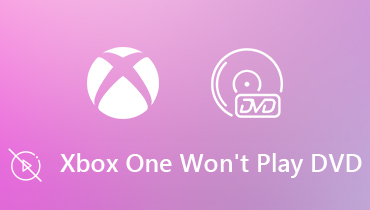 Xbox One이 DVD 오류를 재생하지 않는 문제 수정